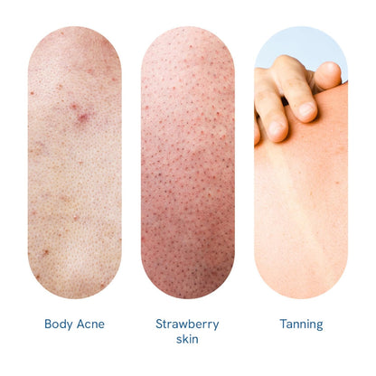 Be Bodywise 12% AHA Body Scrub | Exfoliating Scrub with Glycolic Acid & Lactic Acid | Smoothens Strawberry Skin & Rough Bumps | Oat & Aloe Extract for Hydration | Vitamin E for Skin Protection | 300g