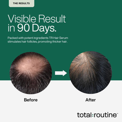 Total Routine Hair Serum for Men - Advanced Formula with 3% Redensyl, 3% Procapil, 4% Capixyl, Saw Palmetto, Collagen & Peptides for Hair Growth & Hairfall Control (50ml - Large)