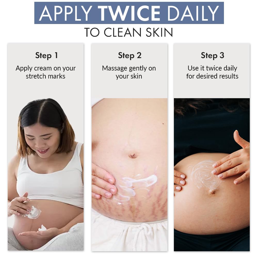 ThriveCo Stretch Marks Expert Serum Cream | Clinically Proven Treatment for New red & Old white Stretch Marks & Scars Removal | Infused with CollarevÂ®, Strioverâ„¢, Rosehip Oil | Women & Men (Stretch Marks 30ML)
