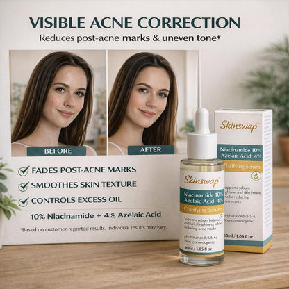 Skinswap Active 14% Niacinamide Serum with Azelaic Acid | Clarifying Face Serum for Brightening & Oil Control | Helps Reduce Acne, Blemishes & Acne Marks | Smooth, Clear-Looking Skin | For Women & Men | 30 ml