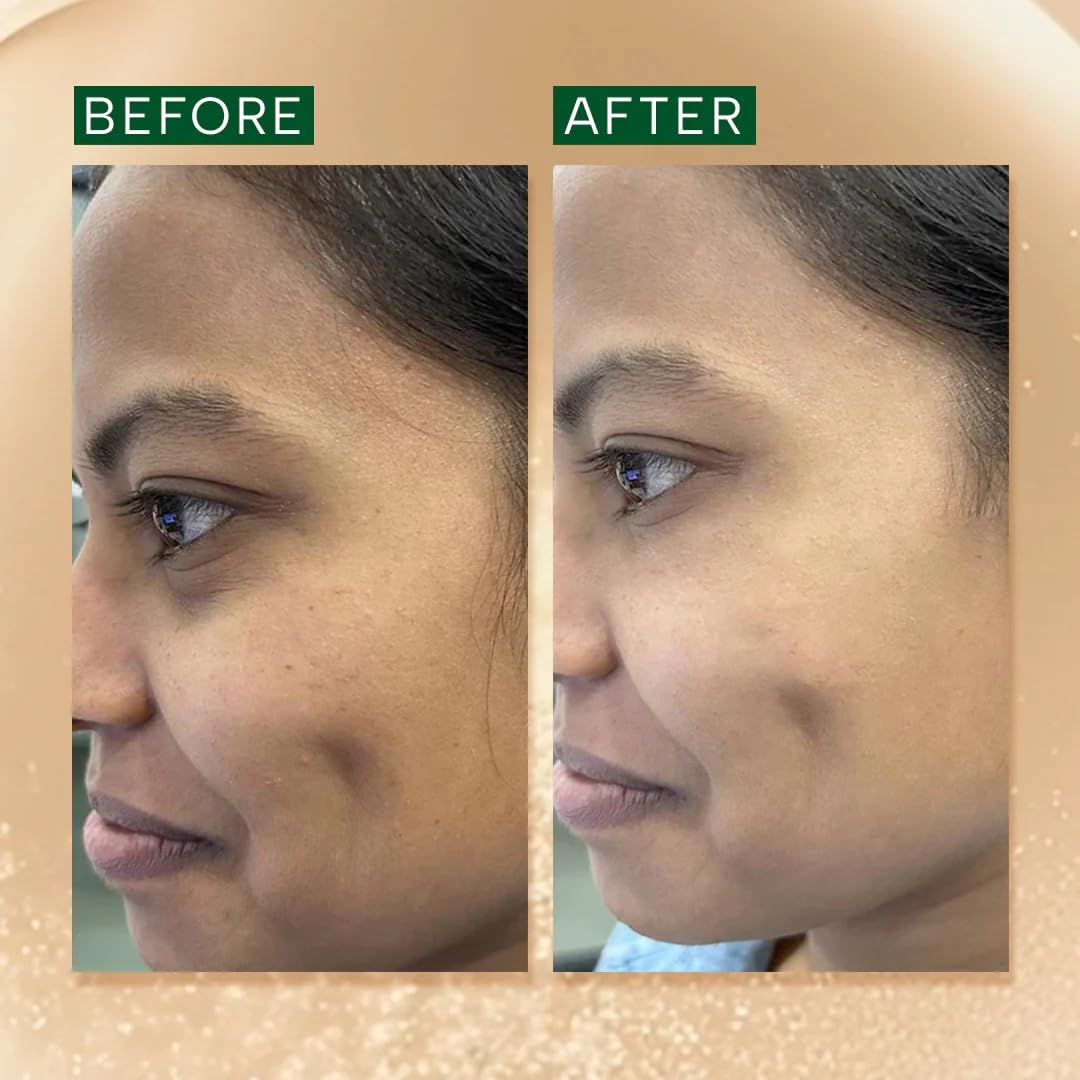 RAS Luxury Oils Brightening & Anti-Pigmentation Advanced Booster Serum