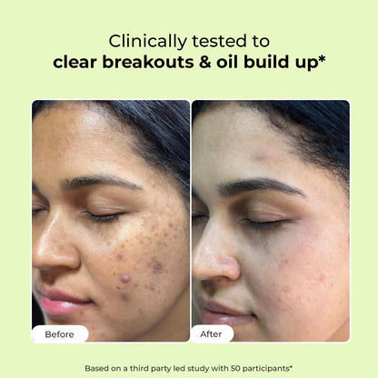 Conscious ChemistÂ® 2% Salicylic Acid Face Wash | 100ml | Face Wash for Oily & Acne Prone Skin for Men & Women, Glycolic Acid & CICA Extract, For Glowing & Radiant Skin, Vegan & Cruelty Free - Flashfix