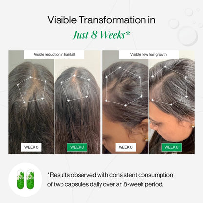 Beautywise HairRescue 30 Capsules| Biotin, Pro Keratin Amino Acids & DHT Blockers | For Hairfall Control & Hair Regrowth | Clinically Tested Ingredients in Dual-Action Capsules | Hair Care Supplement