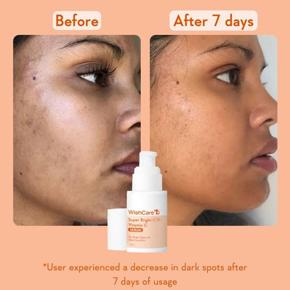 WishCare Super Bright Vitamin C Face Serum and Vitamin C Pure Glow Milk Sunscreen with SPF 50 PA+++(30ml + 50ml), All Skin Type