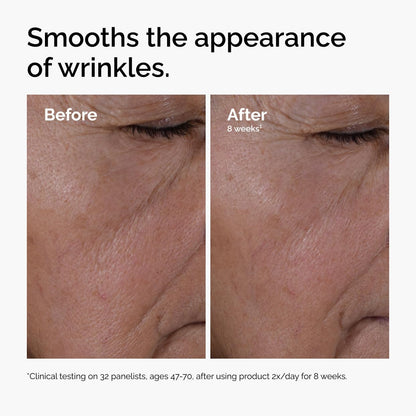The Ordinary Multi-Peptide + HA, Anti-Aging Formula for Crowâ€™s Feet, Elasticity & Firmness, 30ml