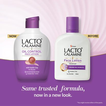 Lacto Calamine Face Lotion | 120ml | Daily Moisturizer For Face - Oily Skin | Kaolin Clay, Glycerine & Zinc Oxide | Abosrbs Excess Oil | Fights Pimples, Darkspots & Blackheads | Body Lotion