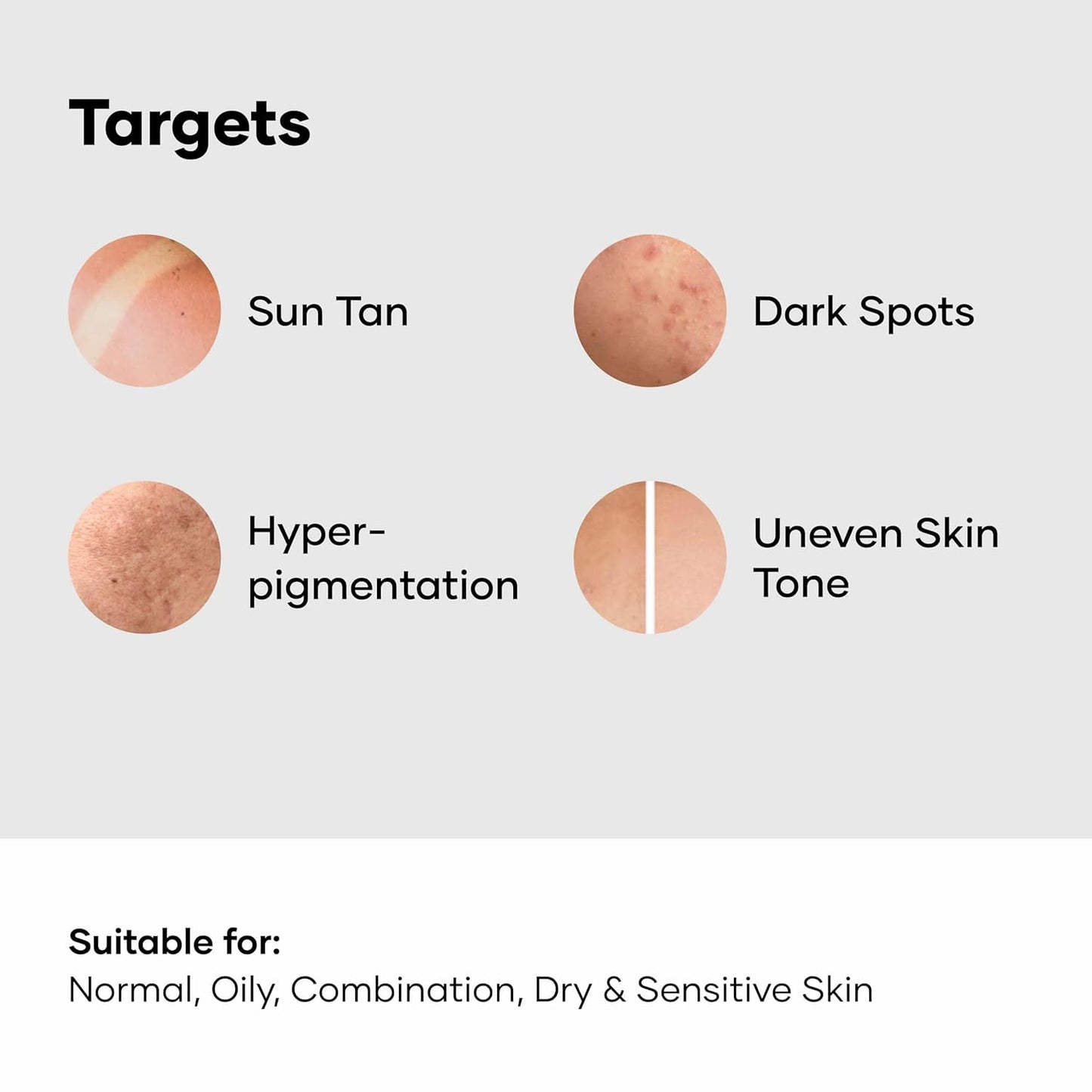 Cureskin Kojic Acid Face Cream for Pigmentation, Tan Removal & Dark Spot Correction | Brightening Night Cream with Alpha Arbutin, Niacinamide & Nonapeptide, 50 g (Pack of 1)
