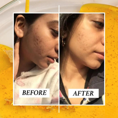 RAS Luxury Oils 24K Gold Radiance Elixir Face Serum for Glowing Skin, Skin Brightening, Reduce Wrinkles, Acne, Dark Spots, Natural & Organic