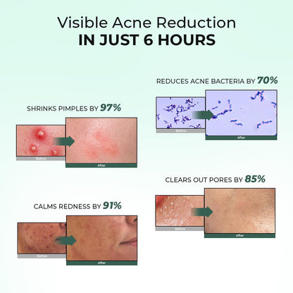 Conscious ChemistÂ® Rapid Relief Acne Spot Corrector Gel | 15g | Triple-Action Treatment with 2% Salicylic Acid & Azelaic Acid | Clears Pimples, Reduces Redness & Fades Dark Spots | For Men & Women