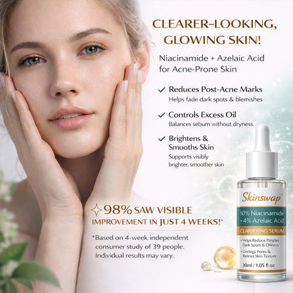 Skinswap Active 14% Niacinamide Serum with Azelaic Acid | Clarifying Face Serum for Brightening & Oil Control | Helps Reduce Acne, Blemishes & Acne Marks | Smooth, Clear-Looking Skin | For Women & Men | 30 ml