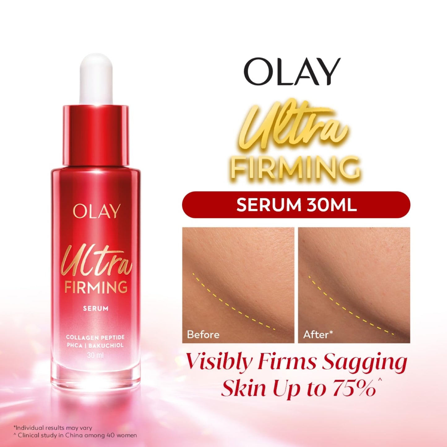 Olay Regenerist Ultra Firming Serum | PHCA, Bakuchiol, Collagen Peptide | Firm and Smooth Skin from Day 1 | Lightweight Texture | Dermatologist Tested | All Skin Types Including Sensitive Skin | 30ml