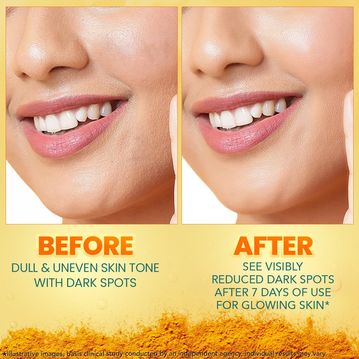 Himalaya Dark Spot Clearing Turmeric Face Serum for glowing skin | with Niacinamide, Glycolic acid & Organically sourced Turmeric | Reduces Dark Spots from Day 7 for Glowing skin | 30ml
