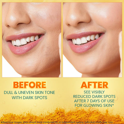 Himalaya Dark Spot Clearing Turmeric Face Serum for glowing skin | with Niacinamide, Glycolic acid & Organically sourced Turmeric | Reduces Dark Spots from Day 7 for Glowing skin | 30ml