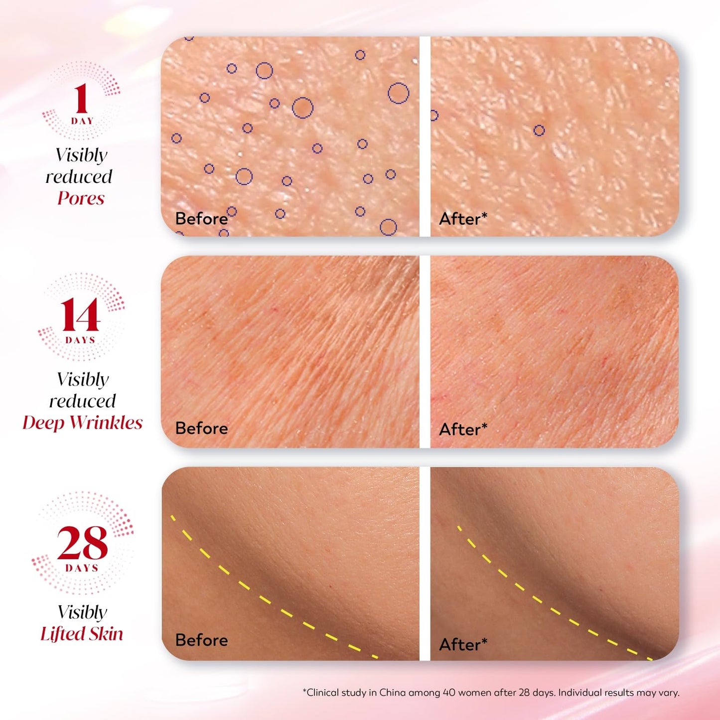 Olay Regenerist Ultra Firming Serum | PHCA, Bakuchiol, Collagen Peptide | Firm and Smooth Skin from Day 1 | Lightweight Texture | Dermatologist Tested | All Skin Types Including Sensitive Skin | 30ml