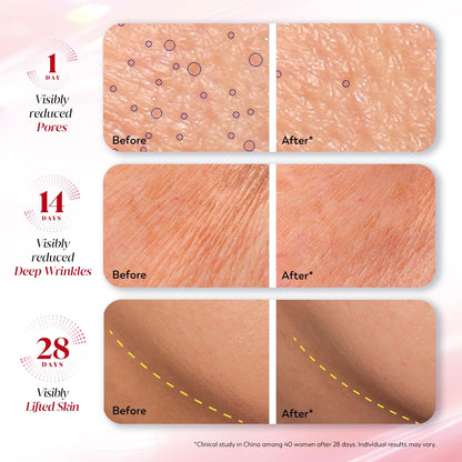Olay Regenerist Ultra Firming Serum | PHCA, Bakuchiol, Collagen Peptide | Firm and Smooth Skin from Day 1 | Lightweight Texture | Dermatologist Tested | All Skin Types Including Sensitive Skin | 30ml