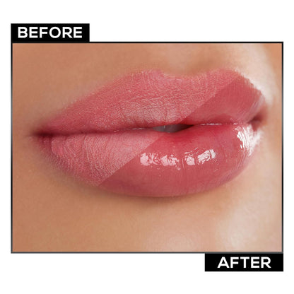 RENEE Hot Lips -Clear Lip Gloss | High-Glossy Shine | Enriched with Vitamin E | Lightweight | Non Sticky | Hydrating Formula | 4.5ml