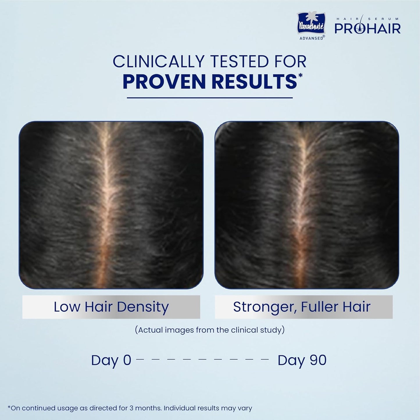 Parachute Advansed Pro Hair Growth Serum for Scalp | With Redensyl, Rosemary, Anagain, Kopexil | Anti Hair fall | Grows New Hair | For Men & Women | 30ml