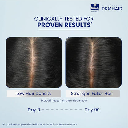 Parachute Advansed Pro Hair Growth Serum for Scalp | With Redensyl, Rosemary, Anagain, Kopexil | Anti Hair fall | Grows New Hair | For Men & Women | 30ml
