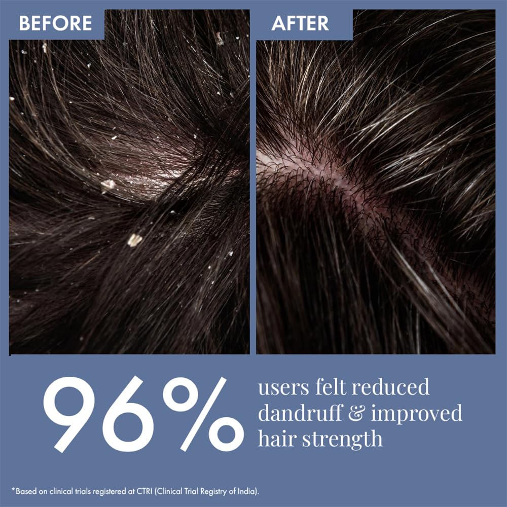 ThriveCo Anti Dandruff Scalp Clear Shampoo | Removes Dandruff from Source | Relieves Flaky, Itchy Scalp, Irritation & Redness | Clinically Proven Zenscalpinâ„¢, Octopirox & Salicylic Acid Formula | For Men & Women | 100ml