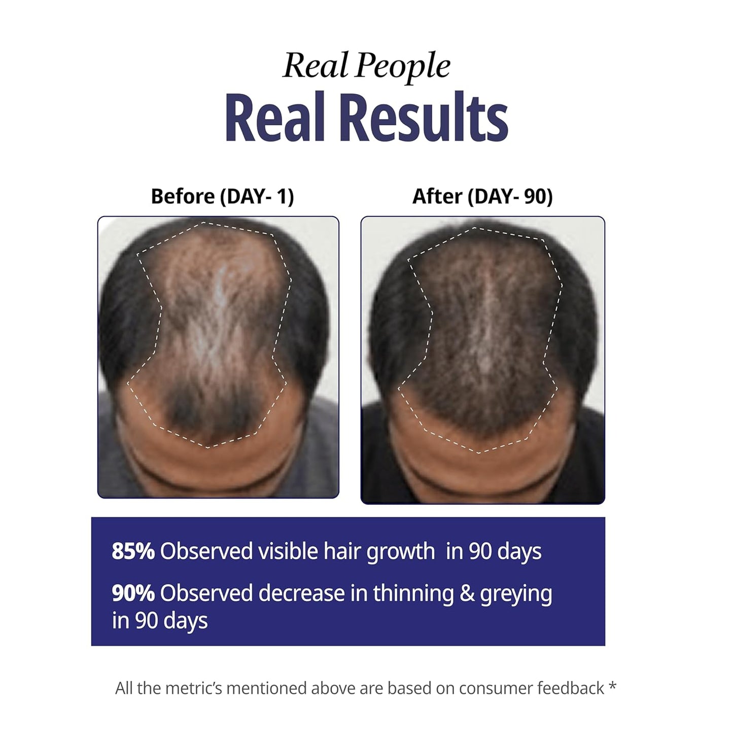 Reginald Men Athena- All in one Hair Growth Serum | Hair Fall Control & Follicle Boost with 12 Actives | Advanced Hair Growth Serum For Scalp | Controls HairFall & Boosts New Hair Growth | For Men | 30ml
