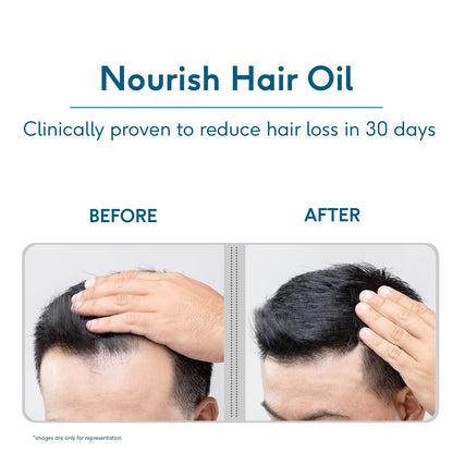HealthKart HK Vitals Headful Nourish Hair Oil with Rosemary, Amla, Bhringraj (100ml) | For Hair Growth & Hair Fall Control