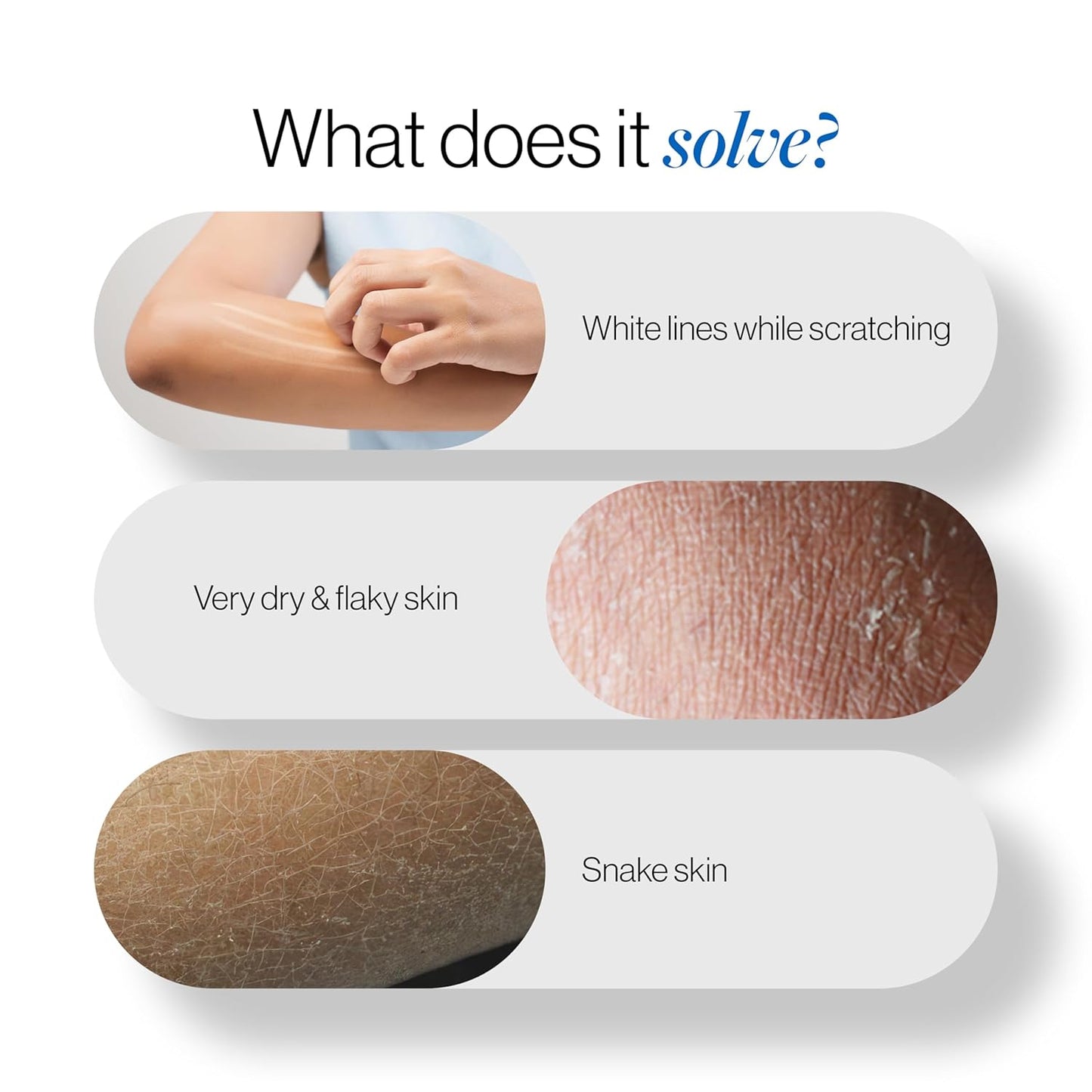 Be Bodywise 20% Urea Body Lotion 300ml | 48 Hrs Moisturization For Very Dry & Flaky Skin| Exfoliates & Repairs Skin Barrier |With Ceramides, Kokum & Mango Seed Butter | Non-Greasy & Lightweight Formula
