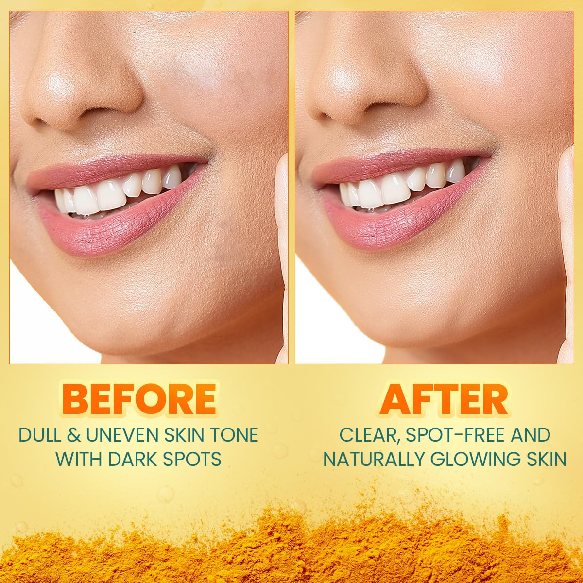 Himalaya Dark Spot Clearing Turmeric Face Serum for glowing skin | with Niacinamide, Glycolic acid & Organically sourced Turmeric | Reduces Dark Spots from Day 7 for Glowing skin | 30ml