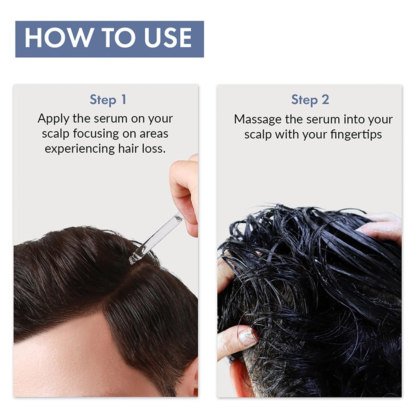 ThriveCo Hair Growth Serum 2.0, Advanced Patent Filed Clinically Proven Scalp Treatment for Hair Fall Control & Regrowth, British Medical Publication, Lightweight, Non-Sticky Solution, Unisex, 50ml