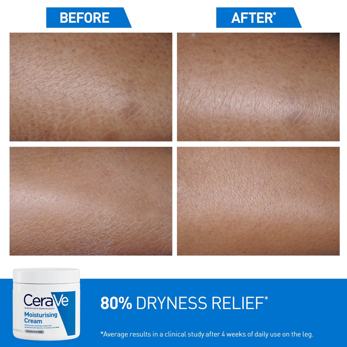 CeraVe Moisturizing Cream For Dry To Very Dry Skin (454g) - Formulated with 3 Essential Ceramides And Hyaluronic Acid | Non-Comedogenic Moisturizer For Face and Body