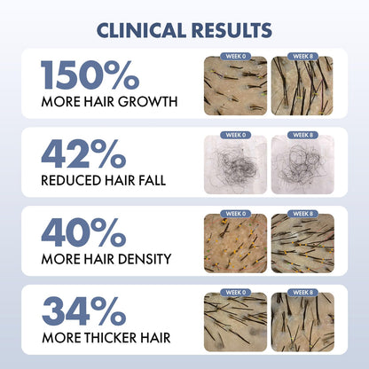 ThriveCo Hair Growth Serum 2.0, Advanced Patent Filed Clinically Proven Scalp Treatment for Hair Fall Control & Regrowth, British Medical Publication, Lightweight, Non-Sticky Solution, Unisex, 50ml