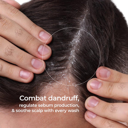 Naturali Scalp Clarifying Anti-Dandruff Shampoo for Men | Derma Approved Shampoo with Green Tea, Hibiscus & Biotin | Reduces Dandruff & Hair Fall | Sulphate-Free Daily Care for All Hair Types | 200 ml