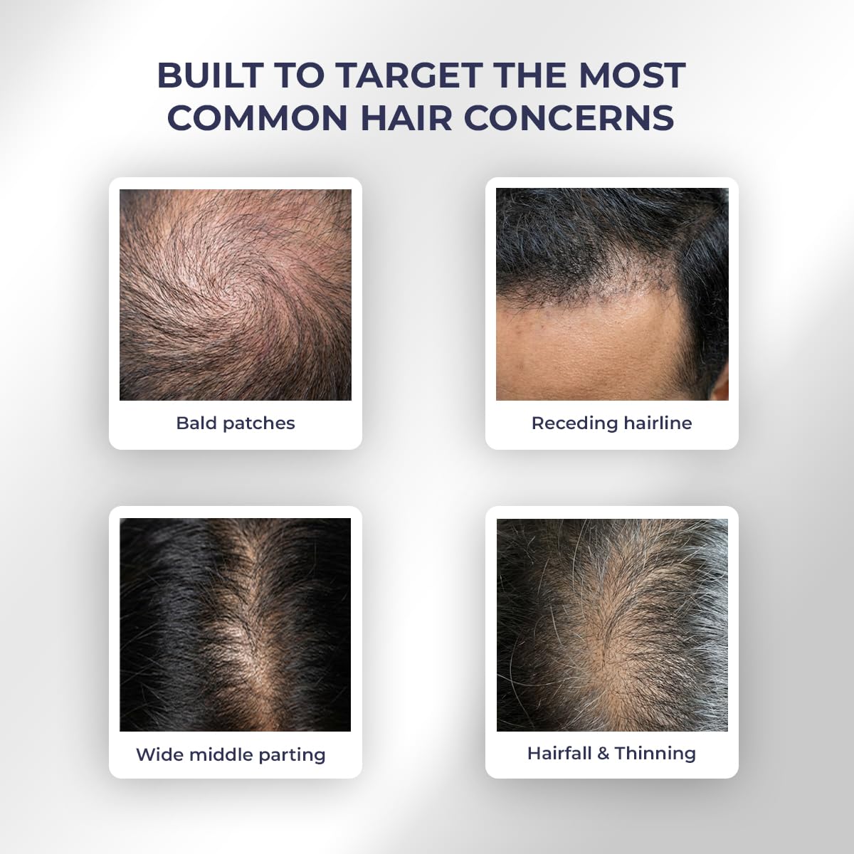 Conscious ChemistÂ® Full Strength Hair Growth Oil | Rosemary, Red Onion & Moringa | With Yeast Extract | 14 Oil Complex | Reduces Hair Fall, Nourishes Scalp & Promotes Hair Growth | For All Hair Types | Women & Men | 100ml