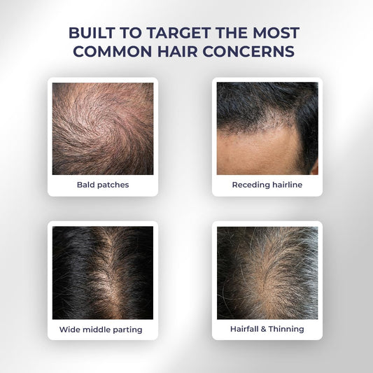 Conscious ChemistÂ® Full Strength Hair Growth Oil | Rosemary, Red Onion & Moringa | With Yeast Extract | 14 Oil Complex | Reduces Hair Fall, Nourishes Scalp & Promotes Hair Growth | For All Hair Types | Women & Men | 100ml