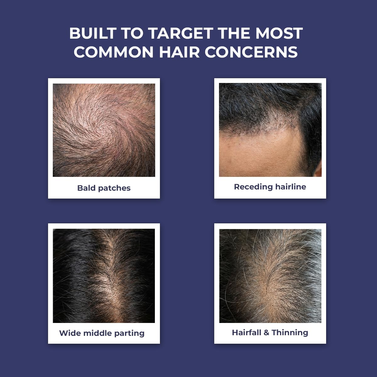 Conscious ChemistÂ® Hair Growth & Anti Hair Fall Serum | Rosemary, Redensyl, Anagain, Procapil, Biotin & Saw palmetto | Controls Hairfall & Boosts New Growth | Improves Hair Density | For Men & Women | 30ml