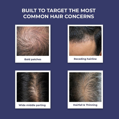 Conscious ChemistÂ® Hair Growth & Anti Hair Fall Serum | Rosemary, Redensyl, Anagain, Procapil, Biotin & Saw palmetto | Controls Hairfall & Boosts New Growth | Improves Hair Density | For Men & Women | 30ml