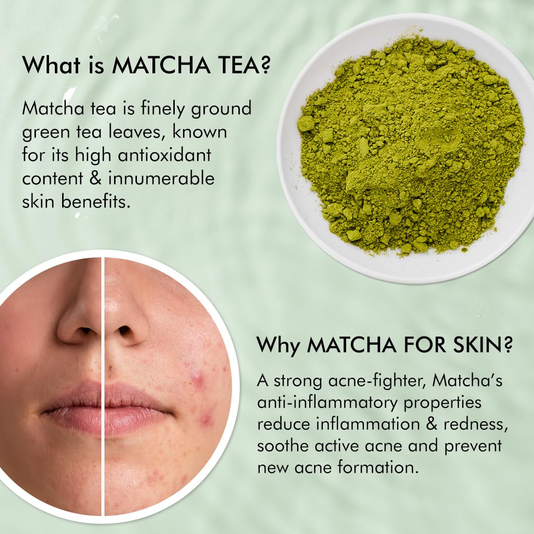 mcaffeine 2% Salicylic Acid Niacinamide & Matcha Tea Face Wash|Anti Acne Cleanser For Pimples|Suitable For Acne Prone & Oily Skin|Fights 99% Bacteria|Sulphate Free Face Wash For Women And Men-100 Ml