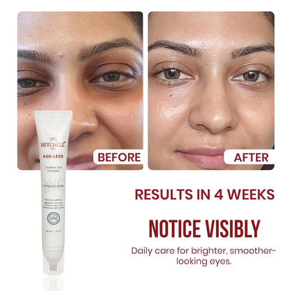 Mitchell USA Lineless Eye Serum â€“ Peptide & Lotus Bio-Repair â€“ Reduces Dark Circles, Wrinkles & Puffiness Lightweight Anti-Aging Formula 15ml