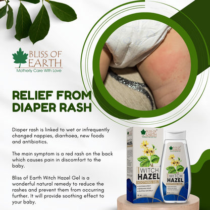 Bliss of Earth Witch Hazel Gel for Hemorrhoids, Diaper Rashes, Postpartum Soothing Relief from Swelling and Discomfort, 110ml