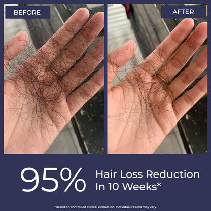 Conscious ChemistÂ® Hair Growth & Anti Hair Fall Serum | Rosemary, Redensyl, Anagain, Procapil, Biotin & Saw palmetto | Controls Hairfall & Boosts New Growth | Improves Hair Density | For Men & Women | 30ml