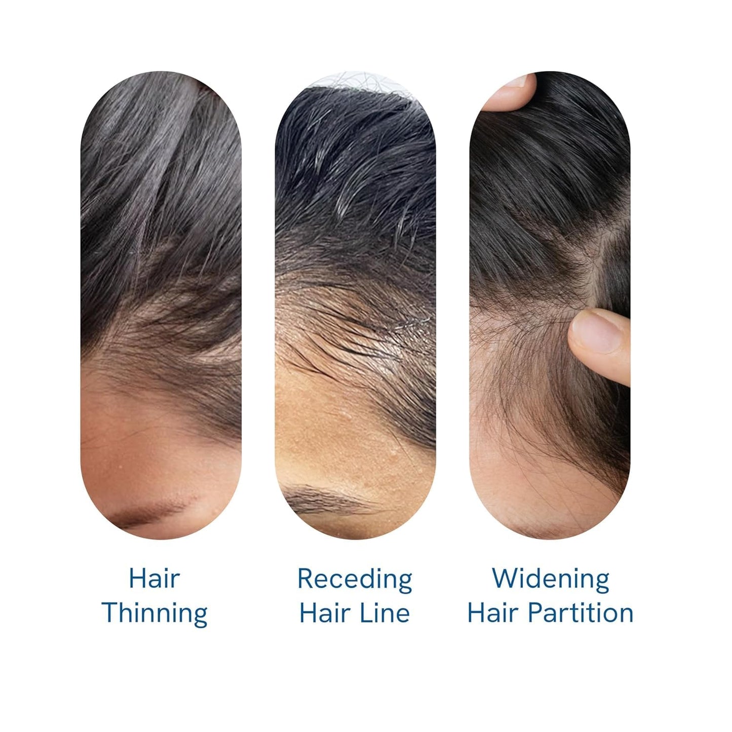 Be Bodywise 3% Redensyl & Rosemary Hair Growth Serum (Roll On) | Pack of 2 |with 2% Anagain | Thicker & Stronger Hair | Prevents Hairfall & Stimulates Hair Follicles | For All Hair Types | 25ml each