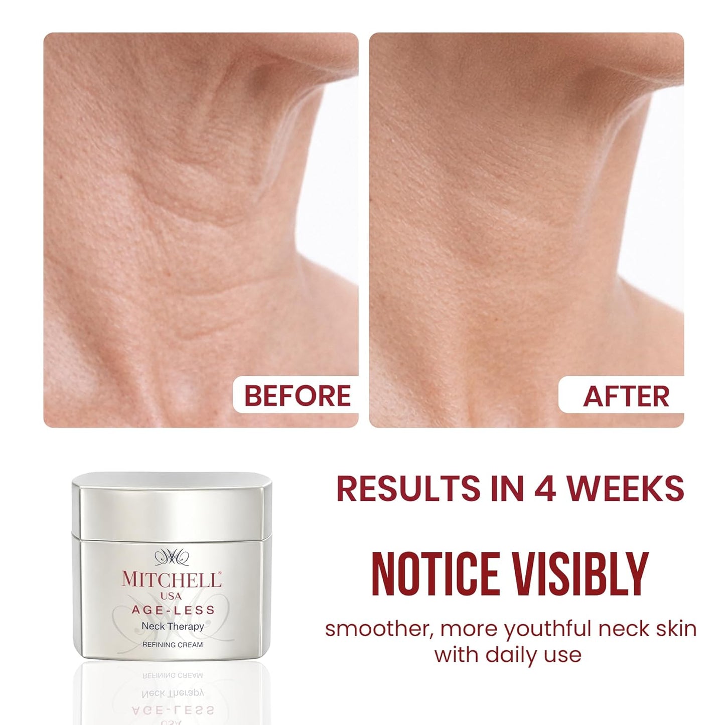 Mitchell USA Anti-Aging Neck Therapy Cream â€“ Firms & Smooths Neck Skin, Reduces Fine Lines | With Lotus Seed Extract & Cocoa Butter | For All Skin Types | 50 g