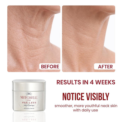 Mitchell USA Anti-Aging Neck Therapy Cream â€“ Firms & Smooths Neck Skin, Reduces Fine Lines | With Lotus Seed Extract & Cocoa Butter | For All Skin Types | 50 g