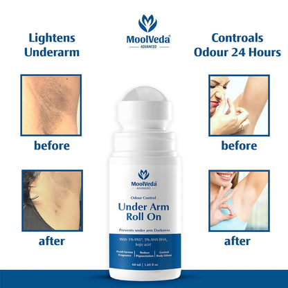 Moolveda 5% AHA BHA Underarm Roll On 60ml - Odour Control & Pigmentation Removal for Men Women | Lactic Mandelic Salicylic Acid | Orchid Breeze