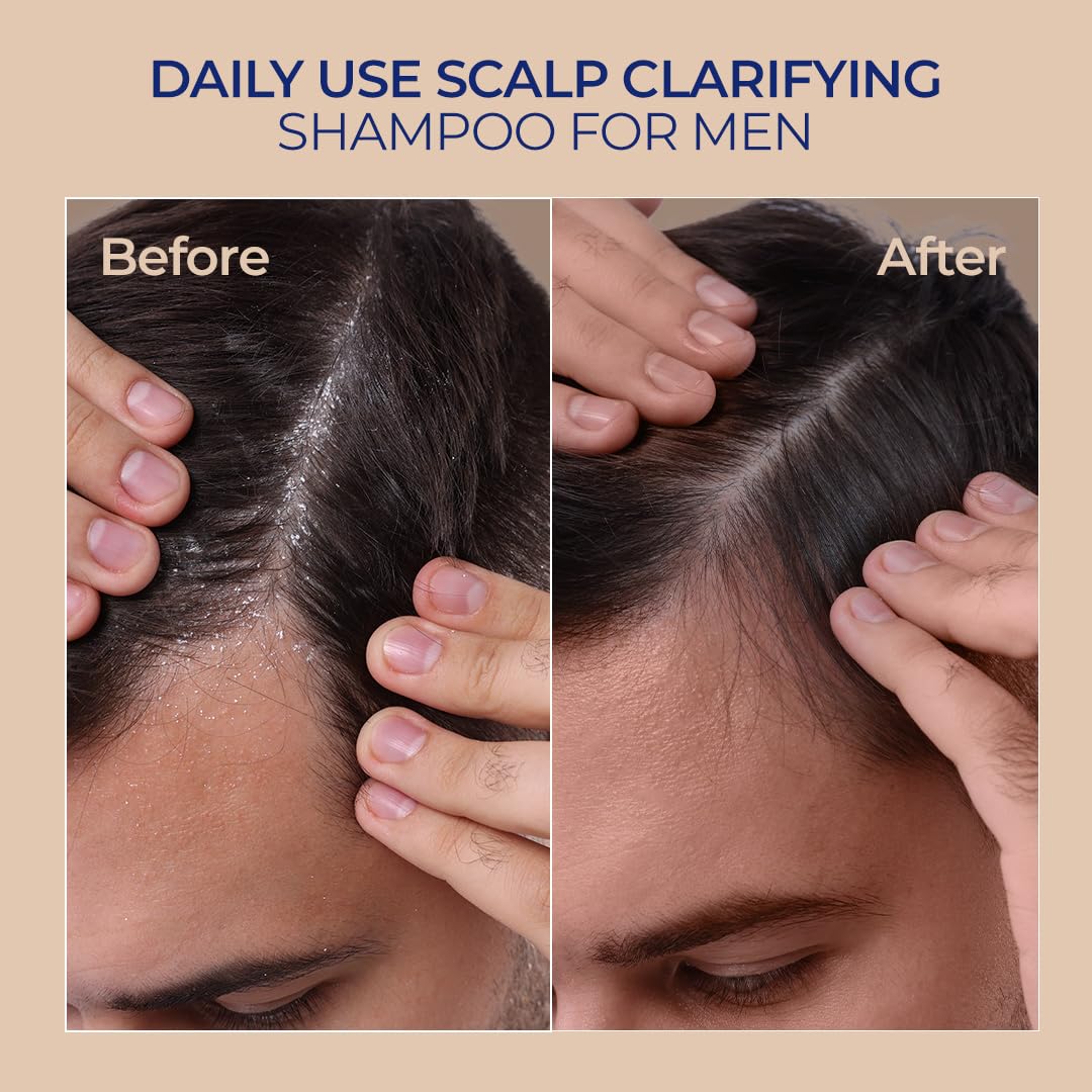 Naturali Scalp Clarifying Anti-Dandruff Shampoo for Men | Derma Approved Shampoo with Green Tea, Hibiscus & Biotin | Reduces Dandruff & Hair Fall | Sulphate-Free Daily Care for All Hair Types | 200 ml