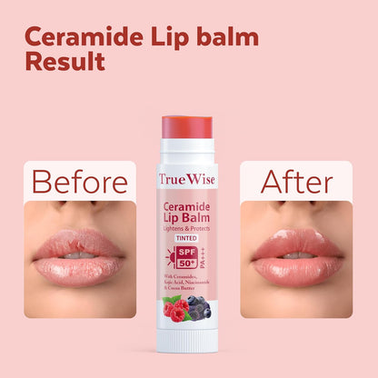 TrueWise Tinted Lip Balm with SPF 50 PA+++ | Brightening Pink Lip Balm For Dark Lips | Ceramides & Kojic Acid,Vitamin E, Soft, Glossy Lips for Women 5g