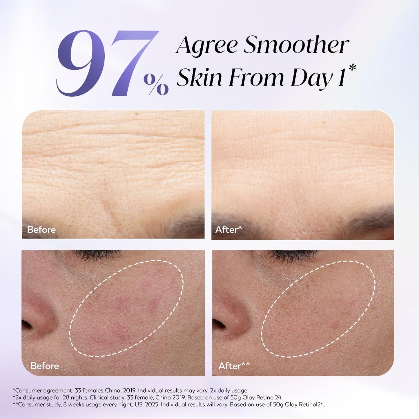 Olay Retinol Night Cream- Mini |with Retinol & Niacinamide |Wake up to plump and bouncy skin from Day 1 |Suitable for Normal, Dry, Oily & Combination skin |8 gm
