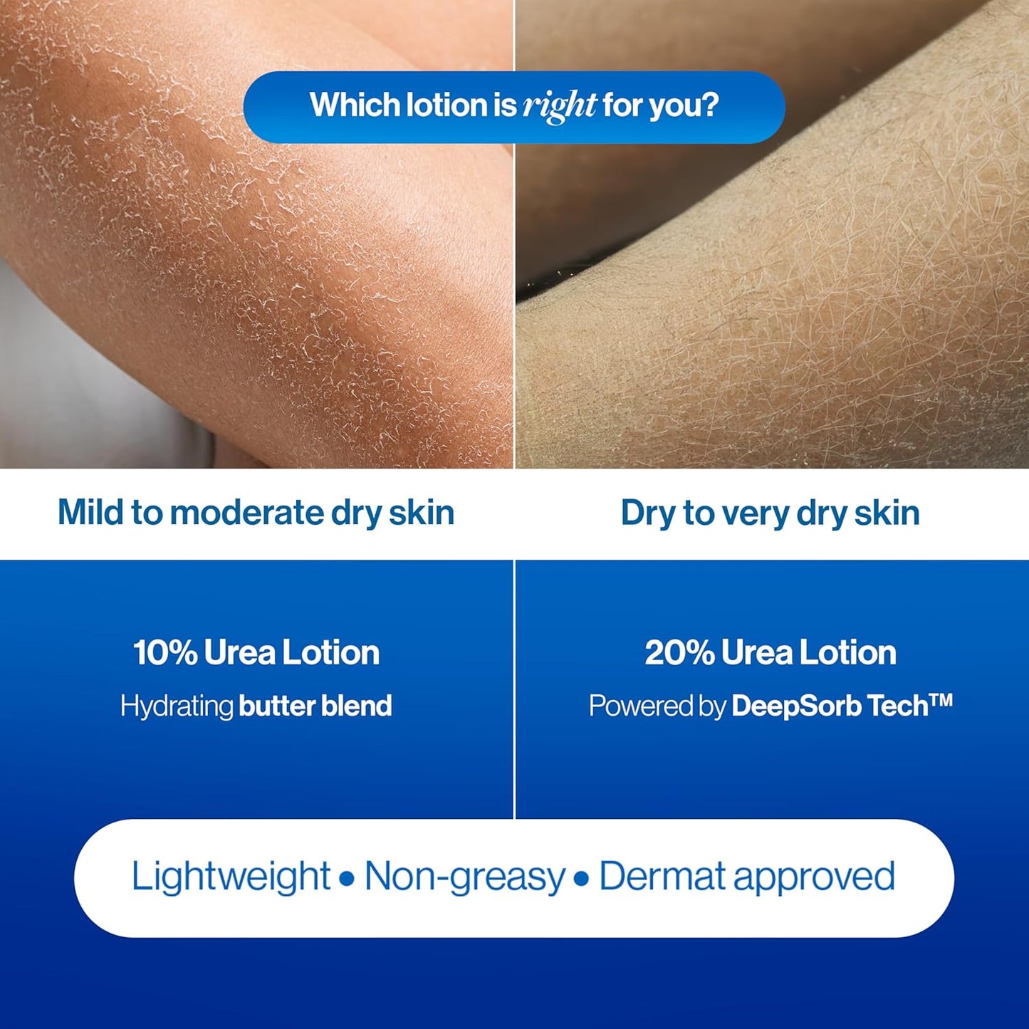 Be Bodywise 20% Urea Body Lotion 300ml | 48 Hrs Moisturization For Very Dry & Flaky Skin| Exfoliates & Repairs Skin Barrier |With Ceramides, Kokum & Mango Seed Butter | Non-Greasy & Lightweight Formula