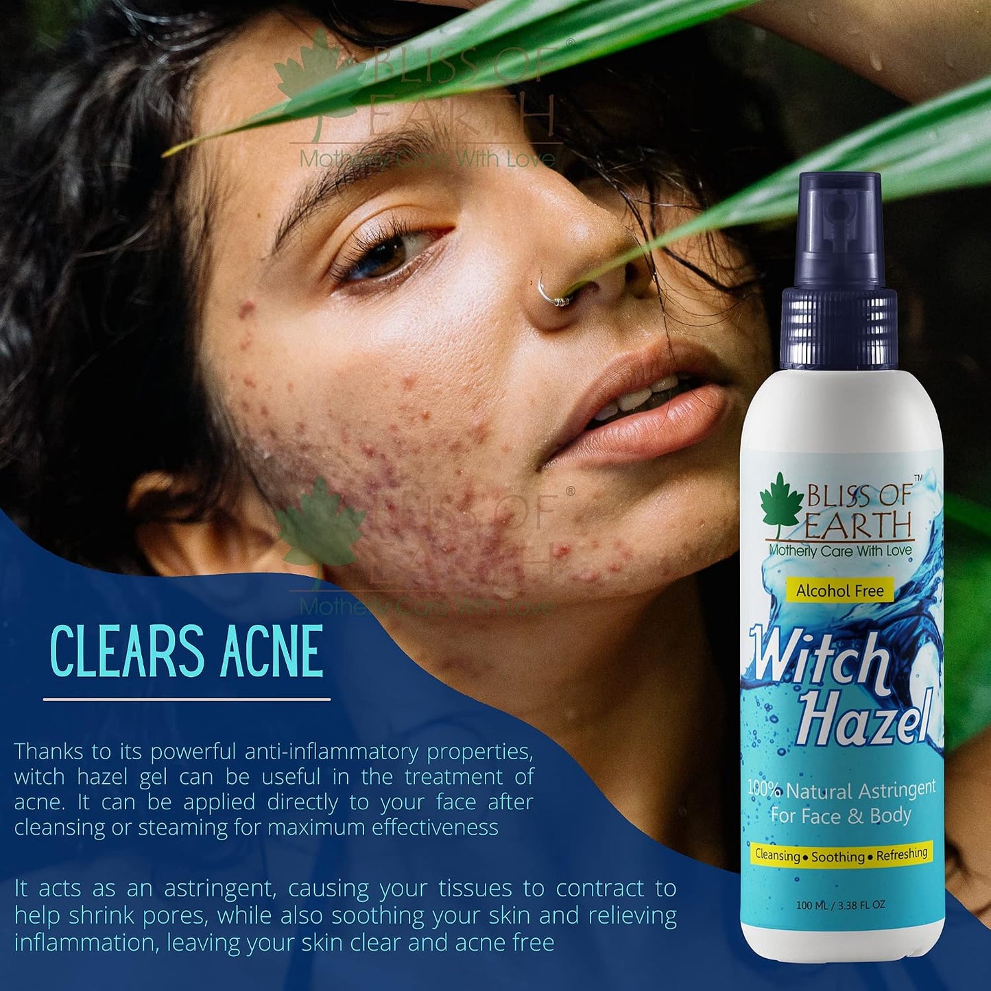 Bliss of Earth Witch Hazel Toner For Face, Acne & Oily Skin, Natural Pore Minimizer, Alcohol Free Facial Astringent, 100ml