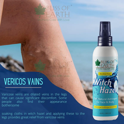 Bliss of Earth Witch Hazel Toner For Face, Acne & Oily Skin, Natural Pore Minimizer, Alcohol Free Facial Astringent, 100ml