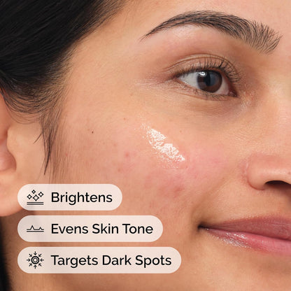 The Ordinary Alpha Arbutin 2% + HA, Brightens Skin and Targets Dark Spots, 30ml